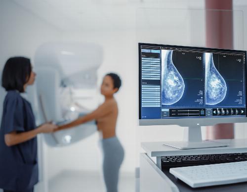 Mammographie et tomosynthèse