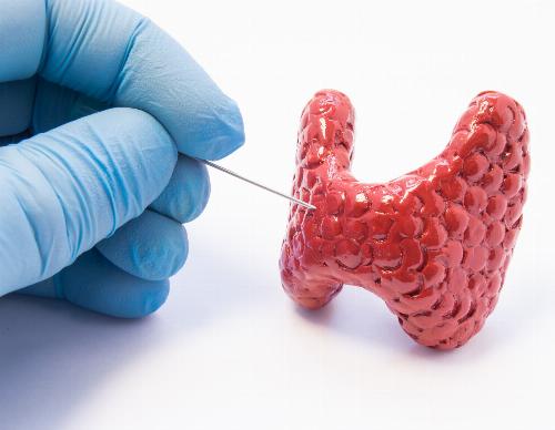 Biopsies et ponctions